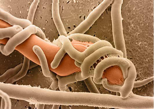  Грибы антагонисты Trihoderma проникают в склероции фитопатогенов и медленно растворяют его клетку изнутри